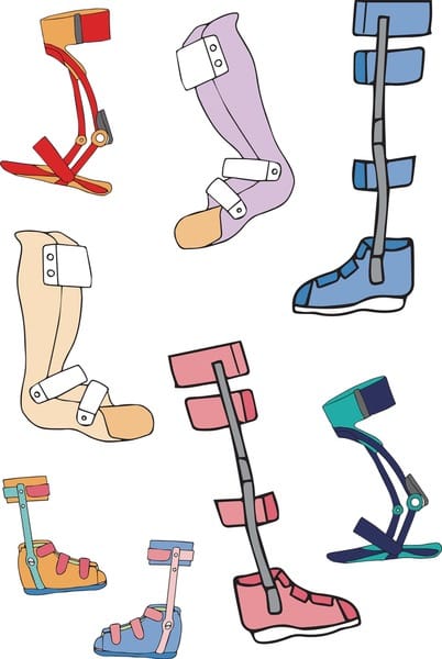 Child using orthotic equipment with therapist support